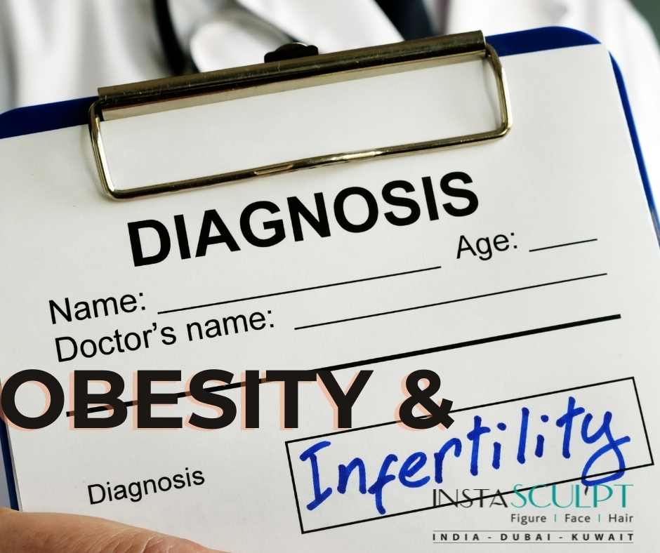 infertility obesity