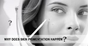 Skin pigmentation