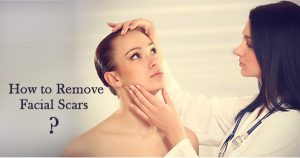 How-to-Remove-Facial-Scars