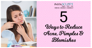 Acne and blemish removal
