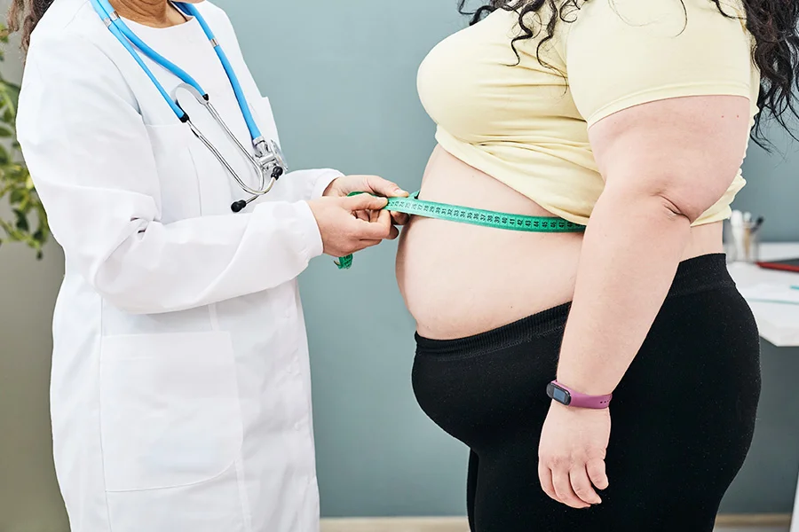 Obesity Overview and Treatment with InstaSculpt