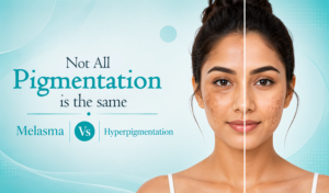 Split-face comparison illustrating the difference between melasma and hyperpigmentation. The left side of the woman's face shows larger, patchy brown discoloration representing melasma, while the right side displays smaller, scattered dark spots representing hyperpigmentation. The graphic includes the text: "Not All Pigmentation is the same – Melasma vs Hyperpigmentation."